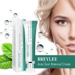 Breylee Acne Scar Removal Cream