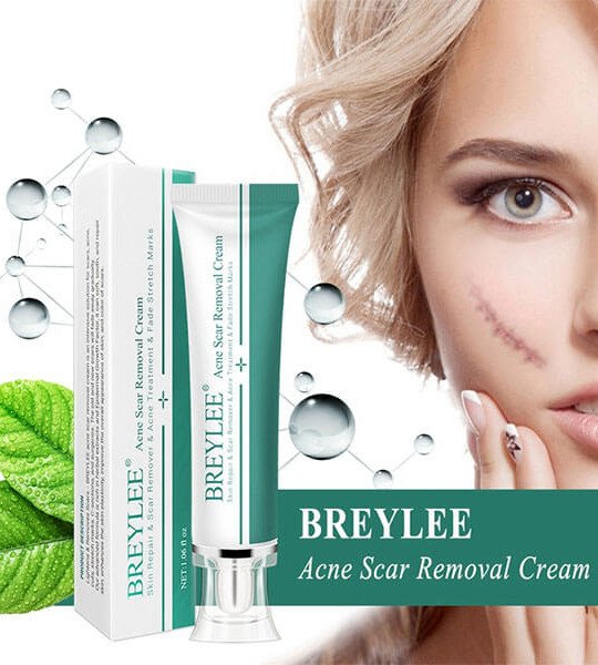 Breylee Acne Scar Removal Cream