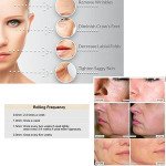 Derma Skin Therapy 540 Micro Needle Derma Roller