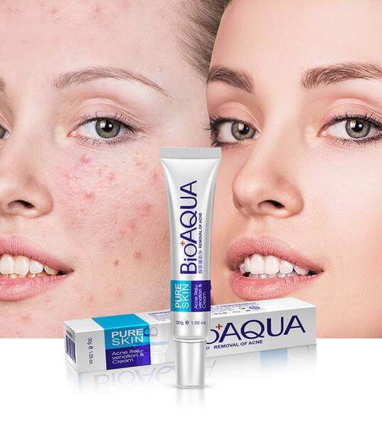 BIOAQUA Pure Skin Acne Removal Cream Acne Cream Treatment Acne Scar Removal Cream